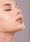 Liplift