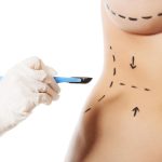 Qual a cirurgia plástica menos arriscada?