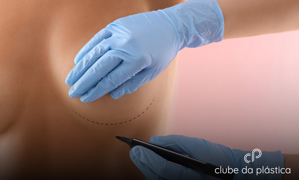 300 ml de silicone é pequeno