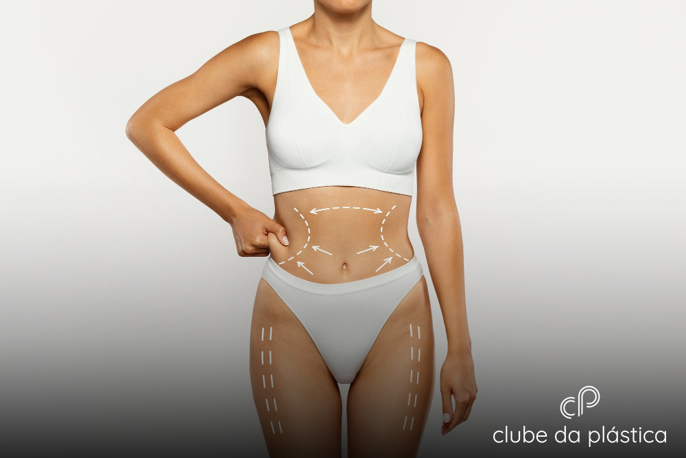 Cirurgia plástica abdominal