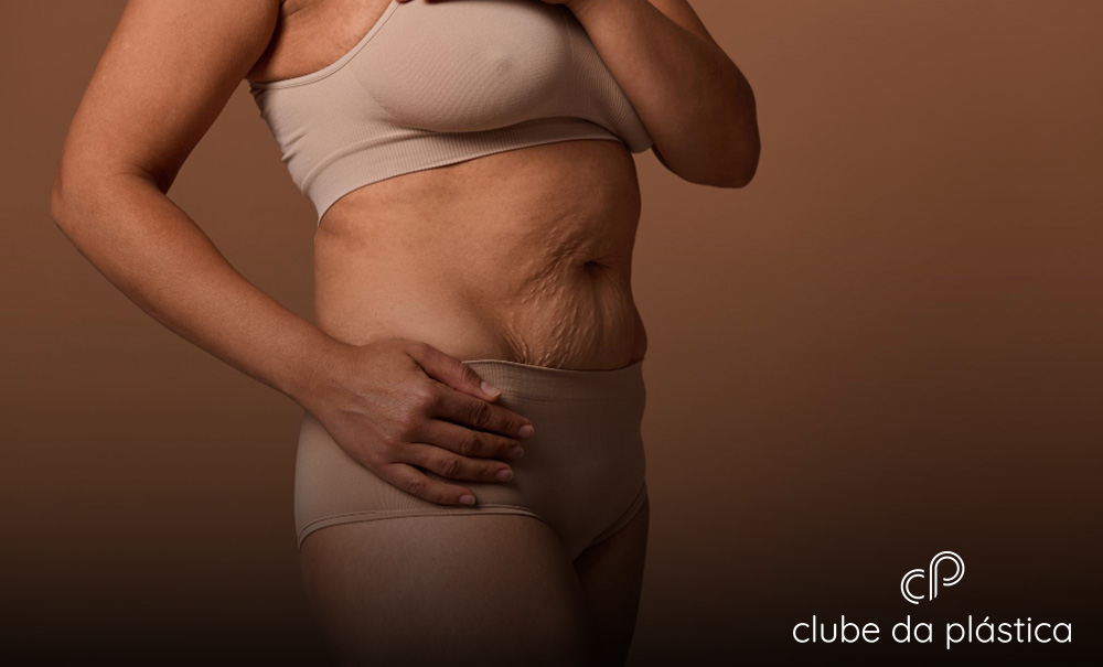 O que muda no corpo depois da abdominoplastia