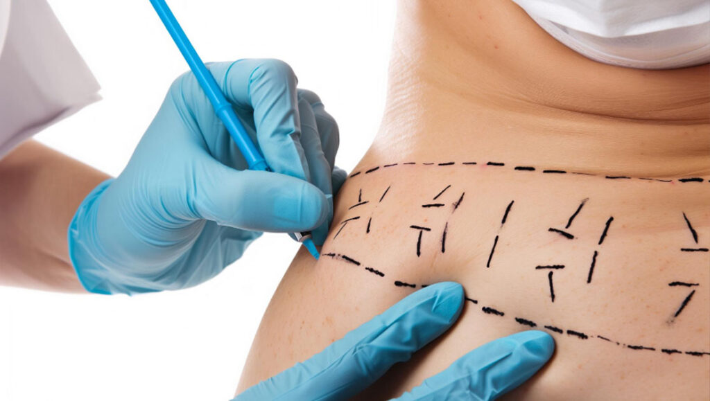 Cirurgião plástico corporal