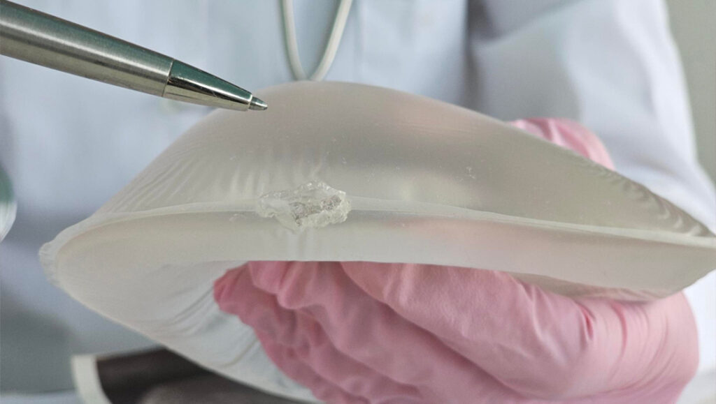 Cirurgião plástico para silicone