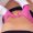 Abdominoplastia
