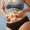 Miniabdominoplastia tradicional