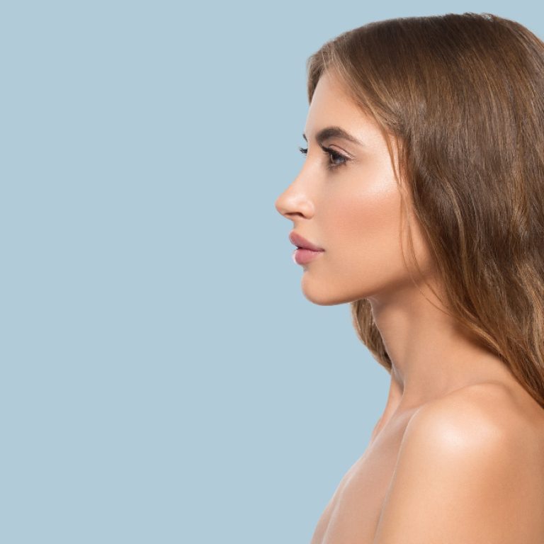 Rinoplastia estruturada