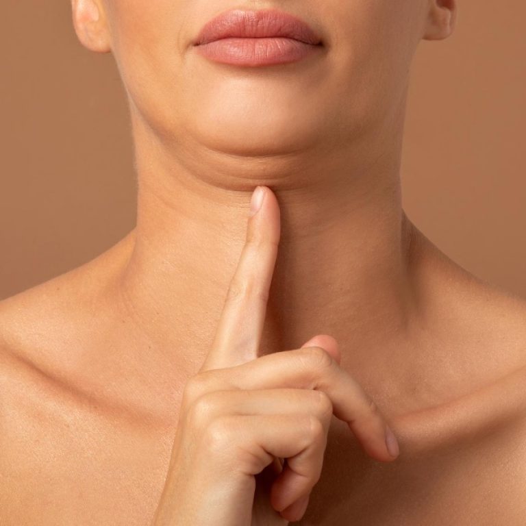 Tratamento da papada